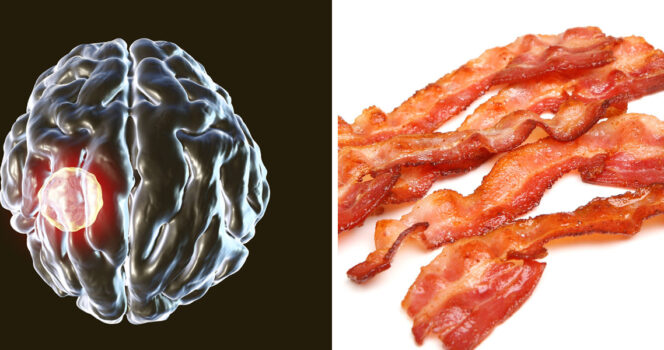 Ein Mann entwickelt nach jahrelanger Einhaltung einer bestimmten Kochgewohnheit „Schweinewürmer“. - BuzzDay