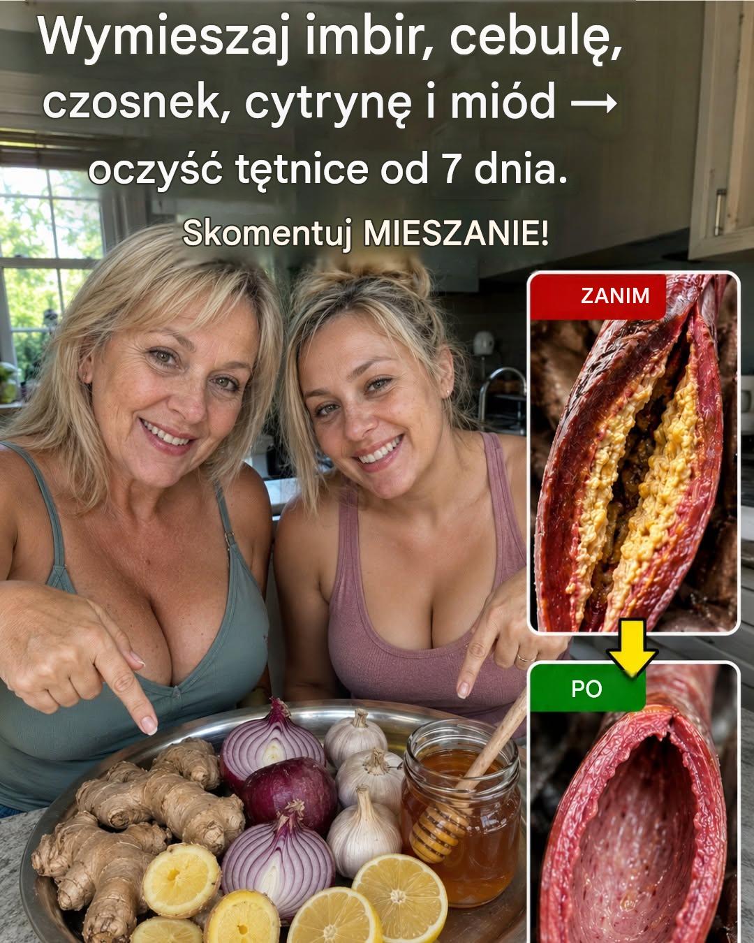 Wymieszaj imbir, cebulę, czosnek, cytrynę i miód, aby zwalczyć zatkane tętnice_c - BuzzDay