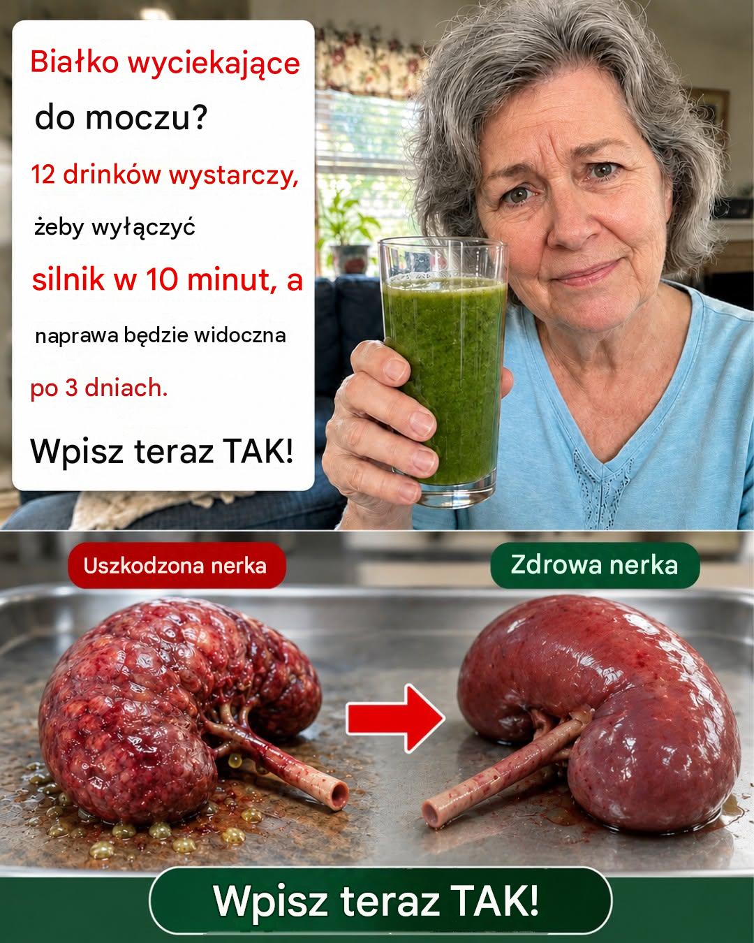 12 codziennych napojów kuchennych, które naturalnie wspomagają pracę nerek, gdy w wynikach badań moczu pojawia się białko_c - BuzzDay