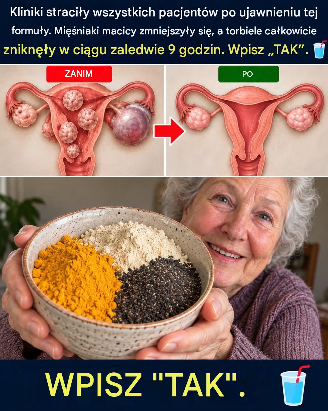 Prawdziwe kobiety opublikowały dowód: Jak ten kuchenny napój wpływa na mięśniaki i torbiele_c - BuzzDay